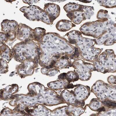 Immunohistochemistry-Paraffin: EVI5 Antibody [NBP1-82596]