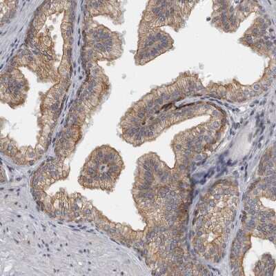 Immunohistochemistry-Paraffin: EVI5 Antibody [NBP1-82596]