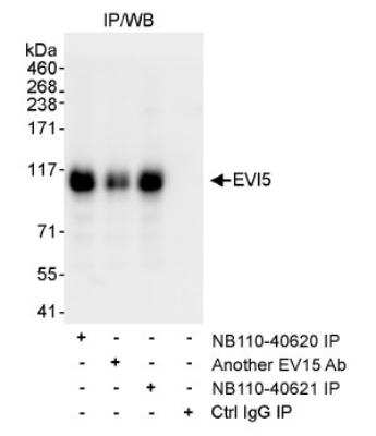 Immunoprecipitation: EVI5 Antibody [NB110-40620]