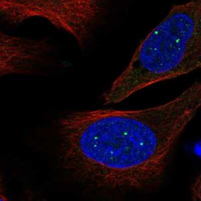 Immunocytochemistry/ Immunofluorescence: EVI5L Antibody [NBP2-54925]