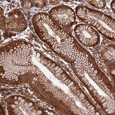 Immunohistochemistry-Paraffin: EVI5L Antibody [NBP1-86206]