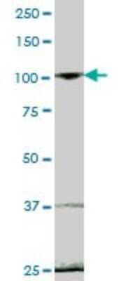 Western Blot: EVI5L Antibody [H00115704-B01P]