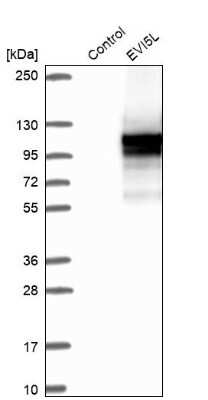 Western Blot: EVI5L Antibody [NBP1-86206]