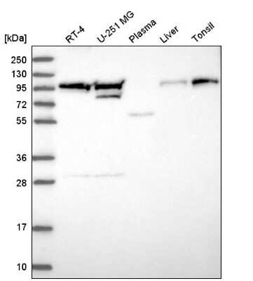 Western Blot: EVI5L Antibody [NBP2-54925]