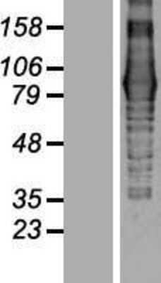 Western Blot: EVI5L Overexpression Lysate [NBP2-05489]