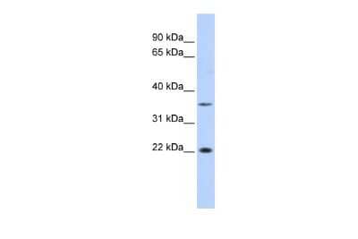 Western Blot: EVORF Antibody [NBP2-84874]