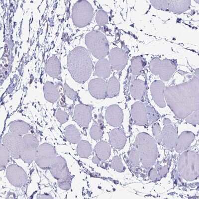 Immunohistochemistry-Paraffin: EVPL Antibody [NBP2-37940]