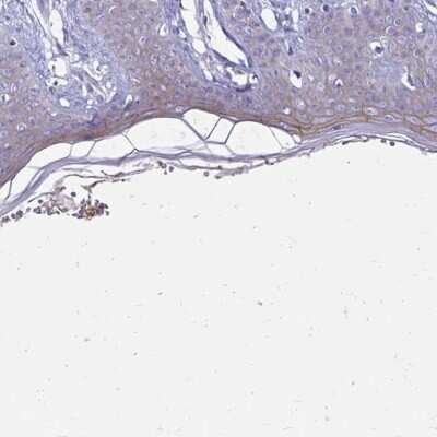 Immunohistochemistry-Paraffin: EVPL Antibody [NBP2-37940]