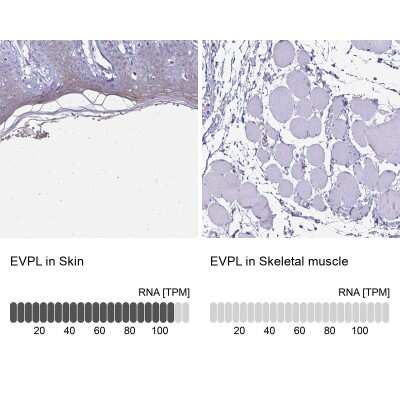 Immunohistochemistry-Paraffin: EVPL Antibody [NBP2-37940]