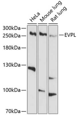 Western Blot: EVPL AntibodyBSA Free [NBP3-04791]