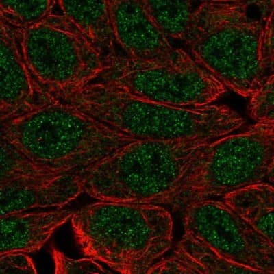 Immunocytochemistry/ Immunofluorescence: EVPLL Antibody [NBP1-94178]