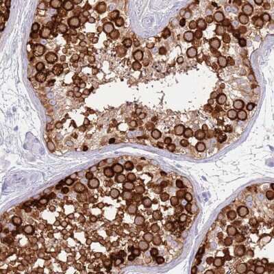 Immunohistochemistry-Paraffin: EVPLL Antibody [NBP1-94178]