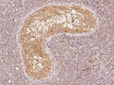 Immunohistochemistry-Paraffin: EVPLL Antibody [NBP2-98178]