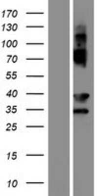 Western Blot: EVPLL Overexpression Lysate [NBP2-09729]