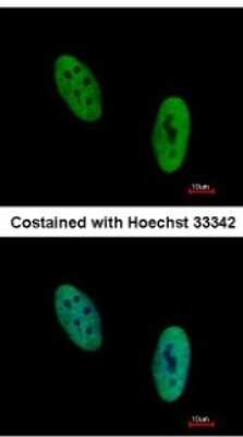 Immunocytochemistry/ Immunofluorescence: EWSR1 Antibody [NBP2-16389]