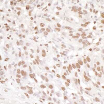 Immunohistochemistry-Paraffin: EWSR1 Antibody [NB200-182]