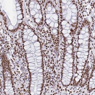 Immunohistochemistry: EWSR1 Antibody [NBP2-49380]