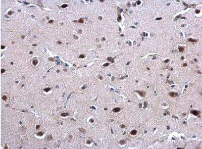 Immunohistochemistry-Paraffin: EWSR1 Antibody [NBP2-16389]