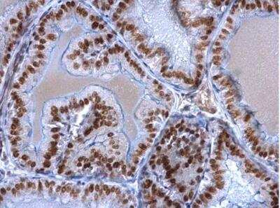 Immunohistochemistry-Paraffin: EWSR1 Antibody [NBP2-16389]