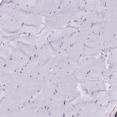 Immunohistochemistry-Paraffin: EWSR1 Antibody [NBP2-49380]
