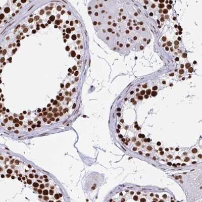 Immunohistochemistry-Paraffin: EWSR1 Antibody [NBP2-49380]