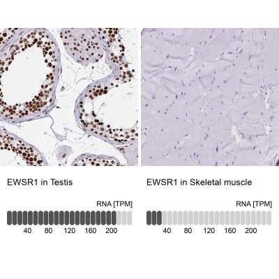 Immunohistochemistry-Paraffin: EWSR1 Antibody [NBP2-49380]