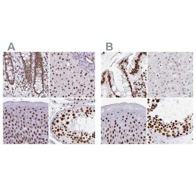 Immunohistochemistry-Paraffin: EWSR1 Antibody [NBP2-49380]