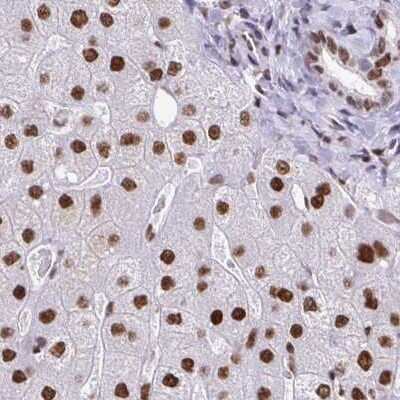 Immunohistochemistry-Paraffin: EWSR1 Antibody [NBP2-49380]