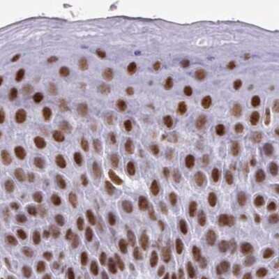 Immunohistochemistry-Paraffin: EWSR1 Antibody [NBP2-49380]