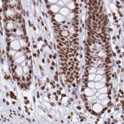 Immunohistochemistry-Paraffin: EWSR1 Antibody [NBP2-49380]