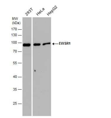 Western Blot: EWSR1 Antibody [NBP2-16389]