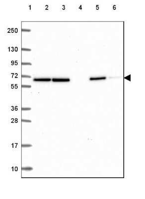 Western Blot: EWSR1 Antibody [NBP2-49380]