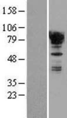 Western Blot: EWSR1 Overexpression Lysate [NBL1-10371]