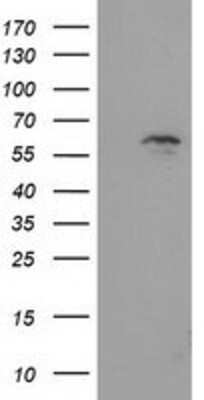 Western Blot: EXD1 Antibody (OTI5B5) [NBP2-03355]