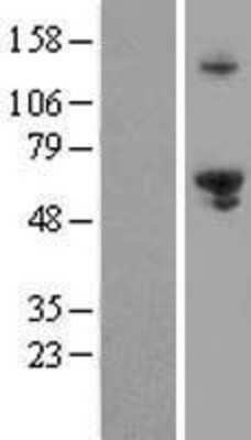 Western Blot: EXD1 Overexpression Lysate [NBL1-10372]