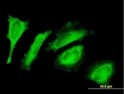Immunocytochemistry/ Immunofluorescence: EXD2 Antibody [H00055218-B01P]