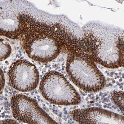 Immunohistochemistry: EXD2 Antibody [NBP1-88404]