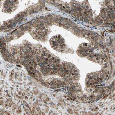 Immunohistochemistry-Paraffin: EXD2 Antibody [NBP1-88405]
