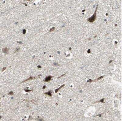 Immunohistochemistry-Paraffin: EXD2 Antibody [NBP1-88405]