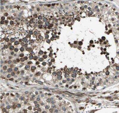 Immunohistochemistry-Paraffin: EXD2 Antibody [NBP1-88405]