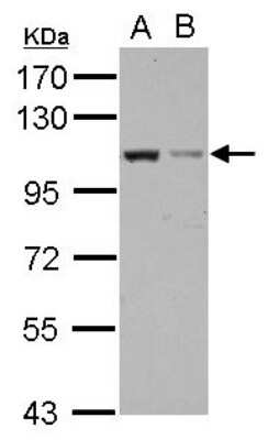 Western Blot: EXOC2 Antibody [NBP2-16390]