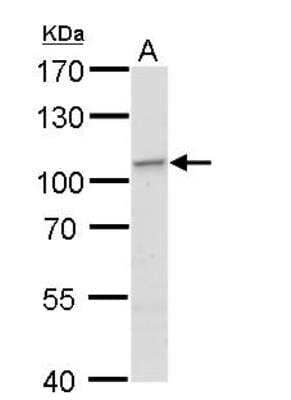 Western Blot: EXOC2 Antibody [NBP2-16390]