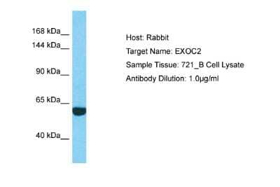 Western Blot: EXOC2 Antibody [NBP2-87377]