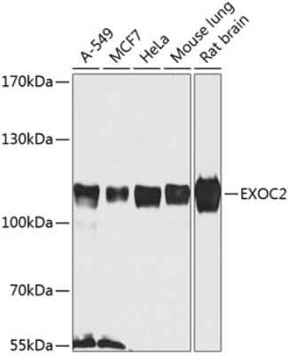 Western Blot: EXOC2 AntibodyBSA Free [NBP3-04535]