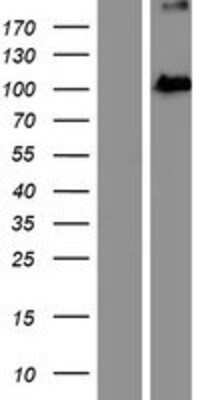 Western Blot: EXOC2 Overexpression Lysate [NBP2-06825]