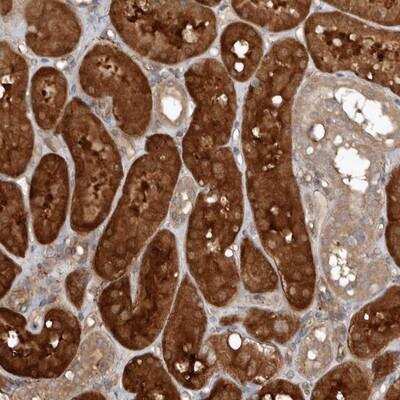 Immunohistochemistry-Paraffin: EXOC3L1 Antibody [NBP1-90471]