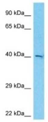 Western Blot: EXOC3L2 Antibody [NBP3-10694]