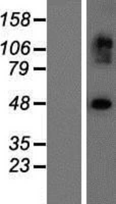 Western Blot: EXOC3L2 Overexpression Lysate [NBP2-05645]