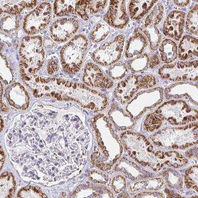 Immunohistochemistry-Paraffin: EXOC5 Antibody [NBP2-31841]