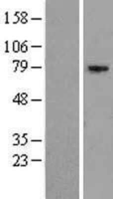 Western Blot: EXOC5 Overexpression Lysate [NBL1-10380]